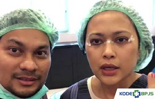 Ini Dia Biaya Operasi Hidung Dr Tompi dan Beberapa Tips Bermanfaat