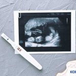 Kode BPJS Abortus Imminens Terbaru