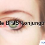 Kode BPJS Konjungtivitis