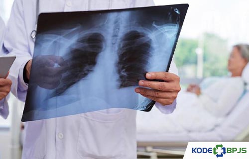 Apa Itu Pneumonia