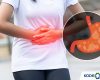 Kode ICD 10 Gastritis Penyebab Gejala Pengobatan