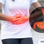 Kode ICD 10 Gastritis Penyebab Gejala Pengobatan