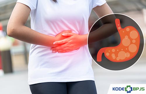 Kode ICD 10 Gastritis Penyebab Gejala Pengobatan