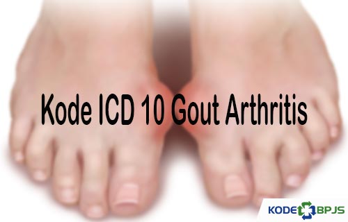 Kode ICD 10 Gout Arthritis