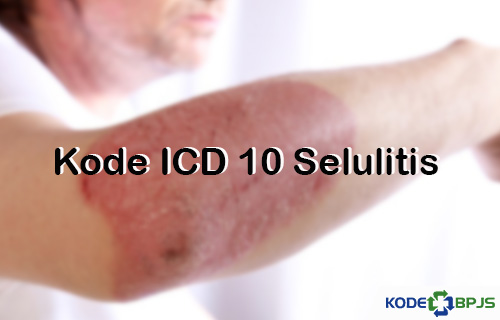 Kode ICD 10 Selulitis