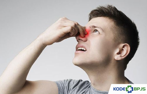 Kode ICD 10 Sinusitis