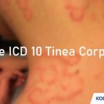 Kode ICD 10 Tinea Corporis