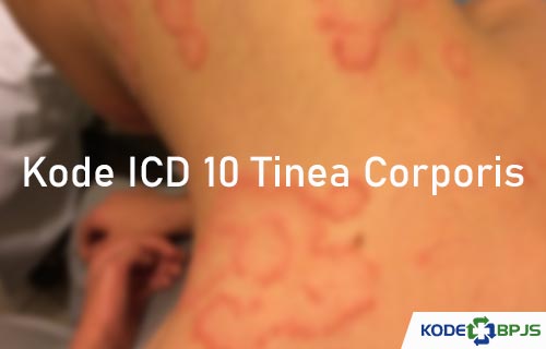 Kode ICD 10 Tinea Corporis