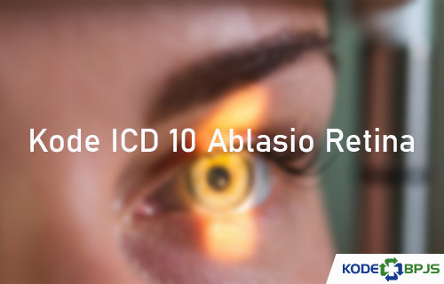 Kode ICD 10 Ablasio Retina