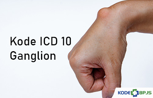 Kode ICD 10 Ganglion