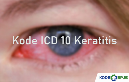 Kode ICD 10 Keratitis