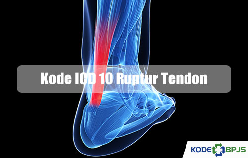 Kode ICD 10 Ruptur Tendon