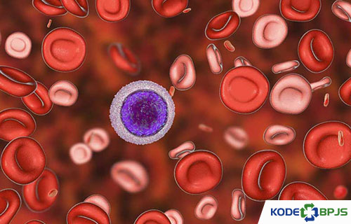 2. Diagnosis Thalassemia Minor
