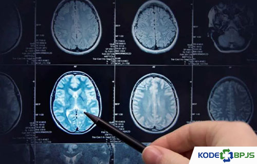 Kegunaan CT Scan Kepala