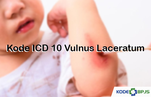 Kode ICD 10 Vulnus Laceratum