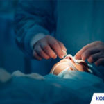 Biaya Operasi Hidung di Jakarta Rumah Sakit Dokter