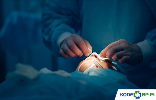 Biaya Operasi Hidung di Jakarta Rumah Sakit Dokter