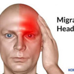 Kode ICD 10 Migrain Penyebab Gejala Cara Mengobati