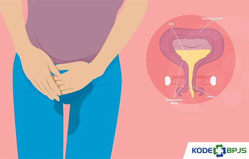 Kode ICD 10 Retense Urine Penyebab Gejala Cara Mengobati