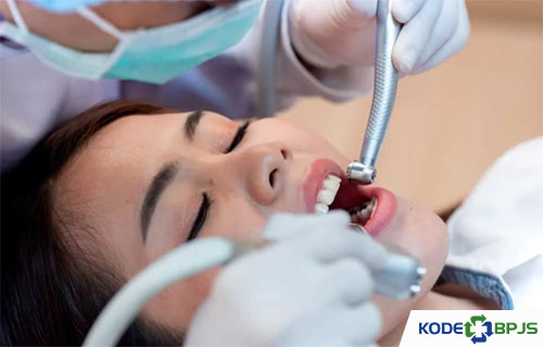 Jenis Perawatan Gigi yang Ditanggung BPJS