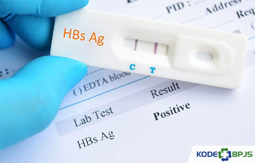 Biaya Tes HBsAg di Puskesmas Pasien Umum BPJS